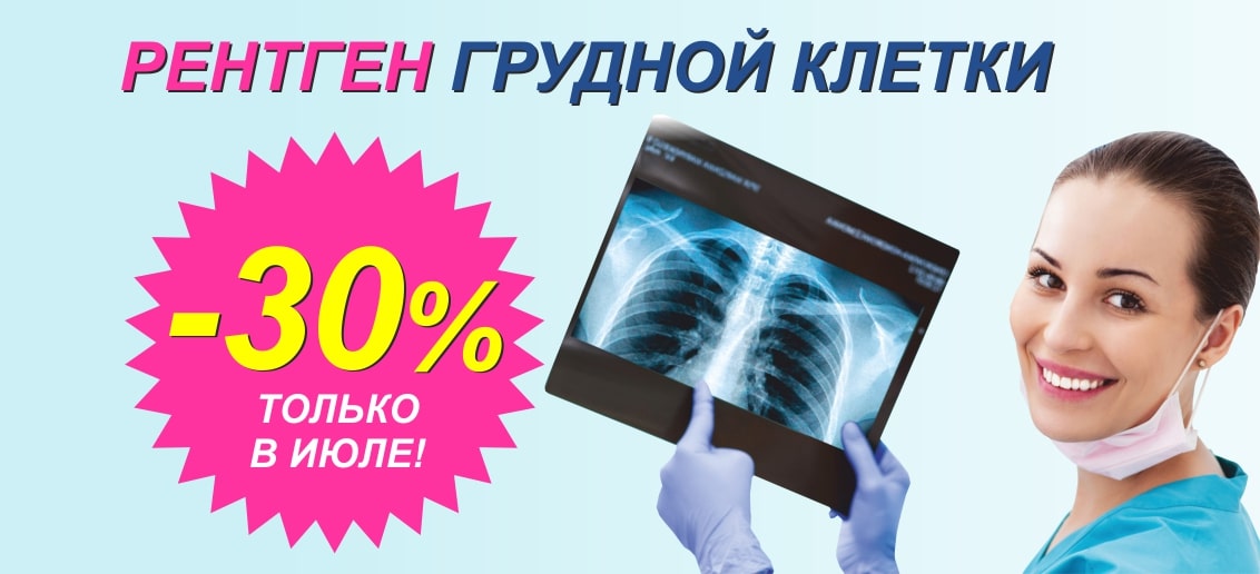 Скидка 30% на рентген грудной клетки (флюорографию) до конца июля!