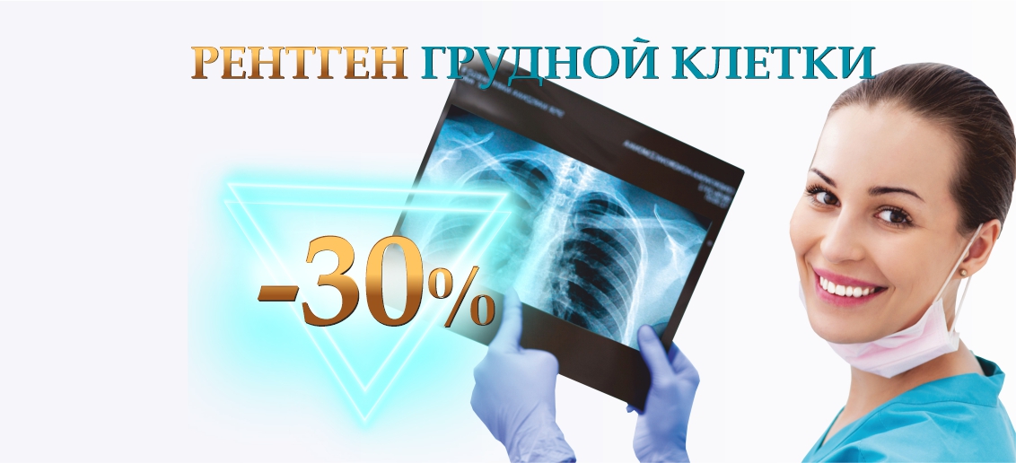 Скидка 30% на рентген грудной клетки – только до конца февраля!